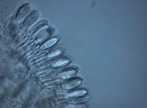 Lisa-Ann Gershwin, Close up (40X magnification) of Malo maxima ‘Broome Irukandji’ jellyfish cnidocil (venom injection apparatus).