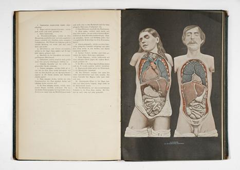 Nikoloaus Rüdinger (1832–1896) Topographisch-chirurgische Anatomie des Menschen / von Dr. Rüdiger Stuttgart: Cotta 1873–78 book Special Collections Baillieu Library 