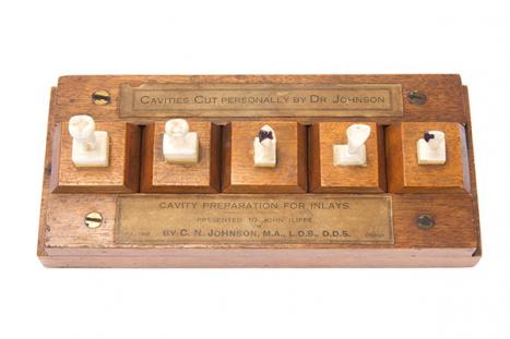 C N Johnson America (1860–1938) Models of cavity preparation showing inlays c1909 wood, ceramic, brass Henry Forman Atkinson Dental Museum Reg. no. 600 