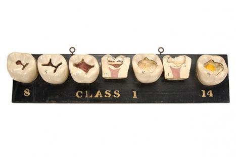 Charles Harold Down Australia (c1893–1965) Models of teeth showing cavity preparation, Black’s Class 1, 8-14 c1922–1938 gypsum, wood, paint Henry Forman Atkinson Dental Museum Reg. no. 824.1 