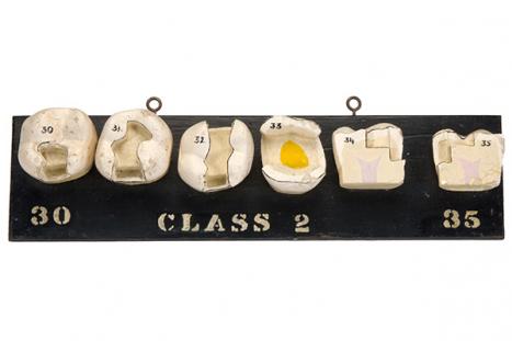 Charles Harold Down Australia (c1893–1965) Models of teeth showing cavity preparation, Black’s Class 2, 30-35 c1922–1938 gypsum, wood, paint Henry Forman Atkinson Dental Museum Reg. no. 824.2 