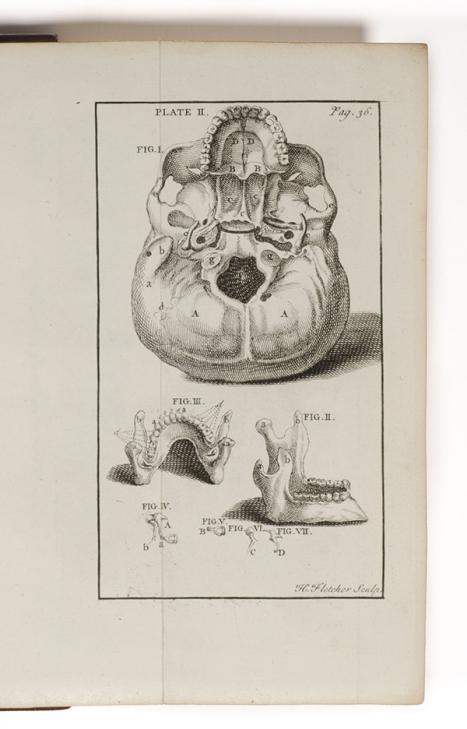 John Hunter (1728–1793) The natural history of the human teeth: explaining their structure, use, formation, growth, and diseases. London: Illustrated with copper-plates / by John Hunter printed for J Johnson 1771 book Special Collections Baillieu Library 