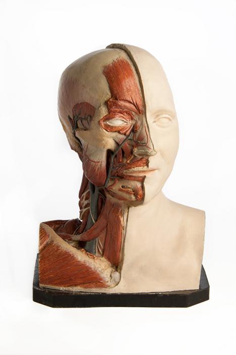 Franz Josef Steger Germany (1845–1938) Bust showing dissected right side of face, neck and thorax. Superficial dissection of brachial plexus, carotid artery and some muscles of facial expression c1900 gypsum, paint Harry Brookes Allen Museum of Anatomy and Pathology 516-500296 