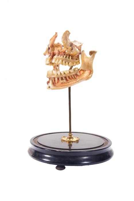 Maker unknown Anatomical teaching model of jaws and teeth, 1885 bone, wax, wood, brass Henry Forman Atkinson Dental Museum Reg. no. 1908