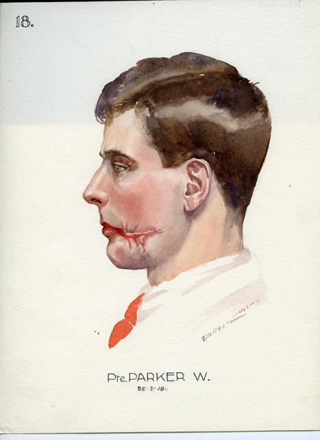 Sir Ernest Daryl Lindsay Australia (1889–1976) Se96/202 Pte W Parker (18) 1918 watercolour, ink, paper Royal Australasian College of Surgeons 