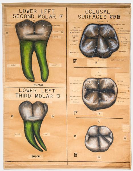 Charles Harold Down Australia (c1893–1965) Tooth anatomy lower left molars c1922–1938 pastel on paper (reproduction) Henry Forman Atkinson Dental Museum