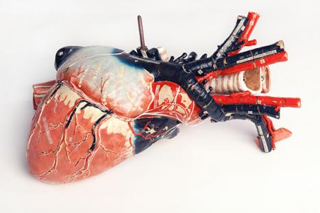 Maison Auzoux France Heart and aorta with removable parts 1889 papier-mâché, paint Harry Brookes Allen Museum of Anatomy and Pathology 516-500277 